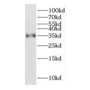 WB analysis of human brain tissue, using CYC1 antibody (1/300 dilution).