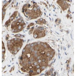 Cyclin B1 (CCNB1) Antibody