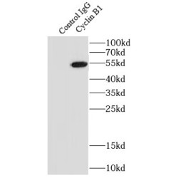 Cyclin B1 (CCNB1) Antibody