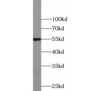 WB analysis of HeLa cells, using CCNB1 antibody (1/500 dilution).