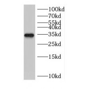 WB analysis of C6 cells, using Cyclin D3 antibody (1/1000 dilution).