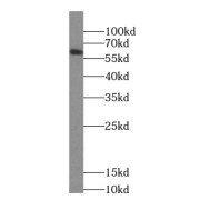 WB analysis of mouse stomach tissue, using Cyclon/CCDC86 antibody (1/500 dilution).