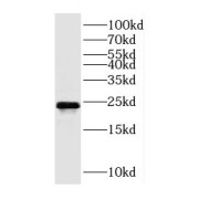 WB analysis of HeLa cells, using Cyclophilin B antibody (1/1000 dilution).