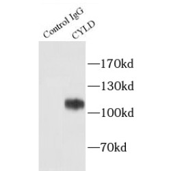 Ubiquitin Carboxyl-Terminal Hydrolase CYLD (CYLD) Antibody