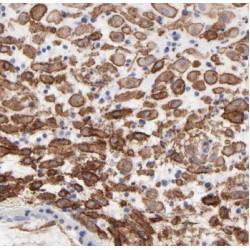 Cytochrome P450 11A1 (CYP11A1) Antibody