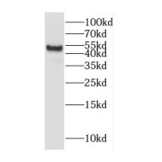 WB analysis of human placenta tissue, using CYP11A1 antibody (1/800 dilution).