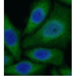 Cytochrome P450 11B2 (CYP11B2) Antibody