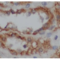 Cytochrome P450 11B2 (CYP11B2) Antibody