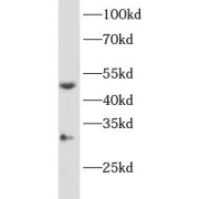 WB analysis of SKOV-3 cells, using CYP11B2 antibody (1/300 dilution).