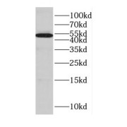 WB analysis of HeLa cells, using CYP17A1 antibody (1/600 dilution).