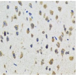 Aromatase (CYP19A1) Antibody