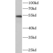 WB analysis of A2780 cells, using CYP19A1 antibody (1/1000 dilution).