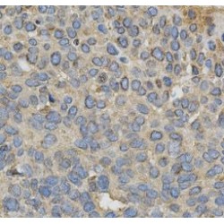 Cytochrome P450 1A1 (CYP1A1) Antibody