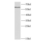 WB analysis of mouse cerebellum tissue, using CYP1A1 antibody (1/1000 dilution).