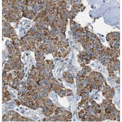 Cytochrome P450 1B1 (CYP1B1) Antibody