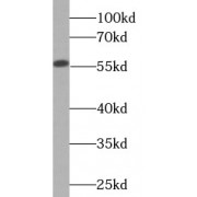 WB analysis of HepG2 cells, using CYP2D6 Antibody.