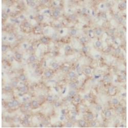 Cytochrome P450 3A4 (CYP3A4) Antibody