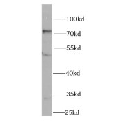 WB analysis of mouse kidney tissue, using CYP3A4 antibody (1/1000 dilution).