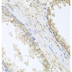 Cholesterol 24-Hydroxylase (CYP46A1) Antibody