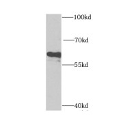 WB analysis of human brain tissue, using CYP46A1 antibody (1/1000 dilution).