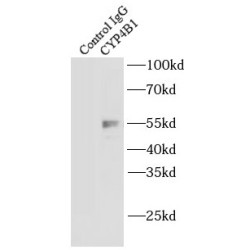 Cytochrome P450 4B1 (CYP4B1) Antibody