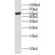 WB analysis of human liver tissue, using CYP4F11 antibody (1/500 dilution).