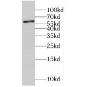 WB analysis of human placenta tissue, using CYP4F12 antibody (1/500 dilution).