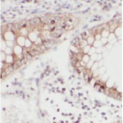 Cystatin B (CSTB) Antibody