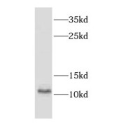 WB analysis of human placenta tissue, using CSTB antibody (1/1500 dilution).