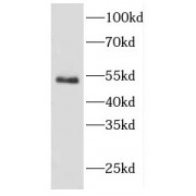 WB analysis of mouse heart tissue, using CYTH2 antibody (1/1000 dilution).