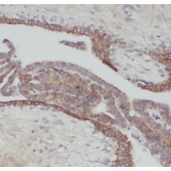 Cytokeratin 18 (CYK18) Antibody