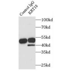 Cytokeratin 18 (CYK18) Antibody