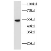 WB analysis of A431 cells, using KRT18 antibody (1/1000 dilution).