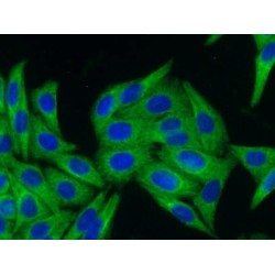 Cytokeratin 18 (CYK18) Antibody