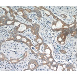 Cytokeratin 18 (CYK18) Antibody