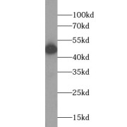 WB analysis of HeLa cells, using KRT18 antibody (1/20000 dilution).