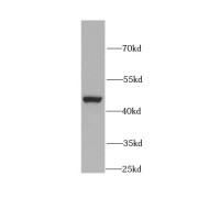 WB analysis of A431 cells, using KRT19 antibody (1/1500 dilution).