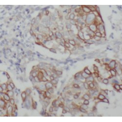 Cytokeratin 19-specific Antibody