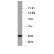 WB analysis of HepG2 cells, using KRT19-specific antibody (1/400 dilution).