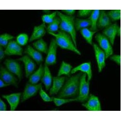 Cytokeratin 20 (CK20) Antibody