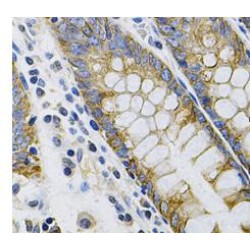 Cytokeratin 20 (CK20) Antibody