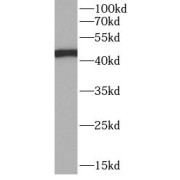 WB analysis of HeLa cells, using KRT20 antibody (1/1000 dilution).