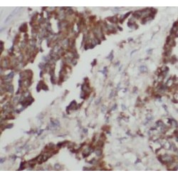 Cytokeratin 6A Antibody