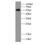 WB analysis of A431 cells, using KRT6A antibody (1/10000 dilution).