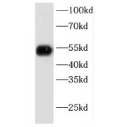 WB analysis of MCF-7 cells, using KRT8 antibody (1/1500 dilution).