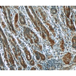 Keratin, Type II Cytoskeletal 8 (KRT8) Antibody