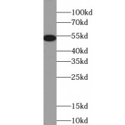 WB analysis of A549 cells, using KRT8 antibody (1/1000 dilution).