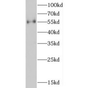 WB analysis of human liver tissue, using D2HGDH antibody (1/500 dilution).