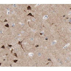 Disheveled-Associated Activator of Morphogenesis 1 (DAAM1) Antibody