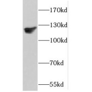 WB analysis of human heart tissue, using DAAM1 antibody (1/500 dilution).